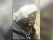 Mulher ataca marido na lua de mel ao assustar-se com o tamanho do pênis dele